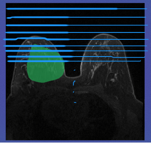 ../_images/Aspose.Words.19819821-06c3-4585-8590-fea343ac9b62.006.png