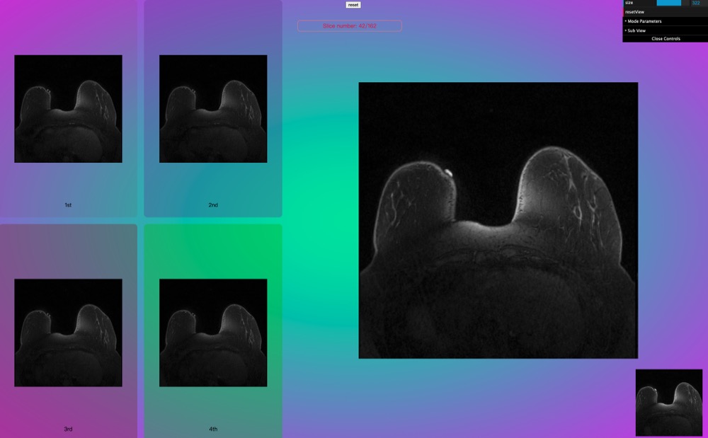../_images/release_1_11_1.jpg